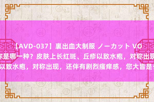 【AVD-037】裏出血大制服 ノーカット VOL.3 中医辨证湿疹，望望你是哪一种？皮肤上长红斑、丘疹以致水疱，对称出现，还伴有剧烈瘙痒感，您大皆是长湿疹了。